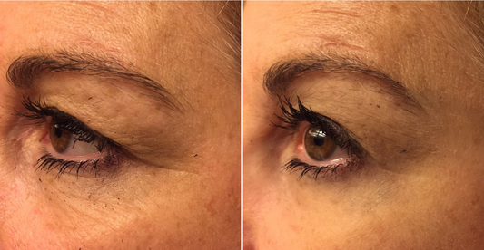 Reflections Pro Formula - Smooth 2 in 1 Instant Lift and Long Term Results