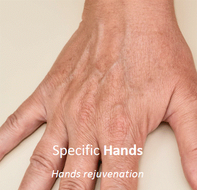 pbserum Specific Hands