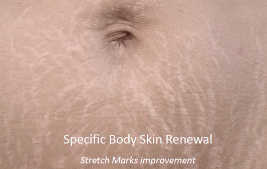 pbserum Specific Striae