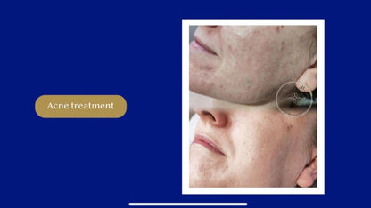 AMiKo CMCA Colostrum Peel is in stock!