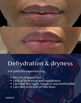A close-up of lips showing dry, chapped lips, with a text banner below reading 'Dehydration & dryness' and bullet points for patients experiencing dry lips. Brand name AMIKO appears at the bottom left.