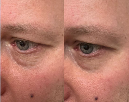 Reflections Pro Formula - Smooth 2 in 1 Instant Lift and Long Term Results