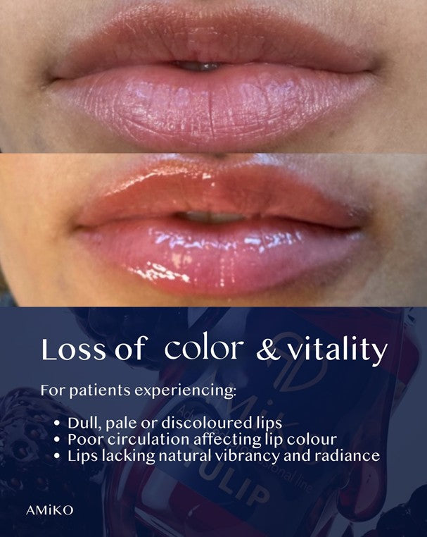 Close-up before-and-after style lip photos with overlaid text reading 'Loss of color & vitality' and a list of symptoms, plus the brand name AMiKO at the bottom left.