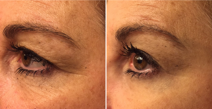 Reflections Pro Formula - Smooth 2 in 1 Instant Lift and Long Term Results