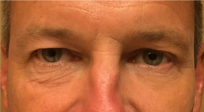 Reflections Pro Formula - Smooth 2 in 1 Instant Lift and Long Term Results