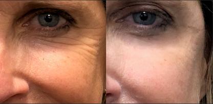 Reflections Pro Formula - Smooth 2 in 1 Instant Lift and Long Term Results