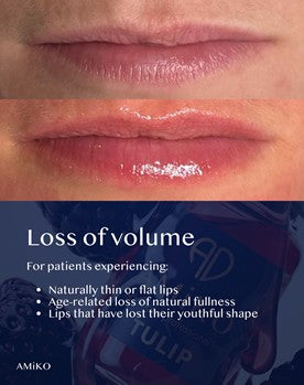 Close-up of lips with text overlay reading 'Loss of volume' and a dark blue lower section with bullet points and a small AMIKO logo.