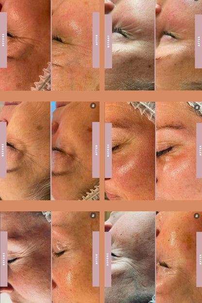 Coolifting+ Starter Kit